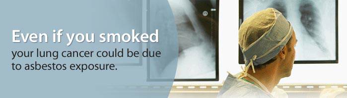 LungCancer_banner