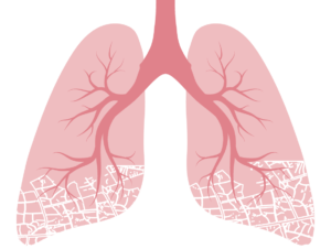 Lungs