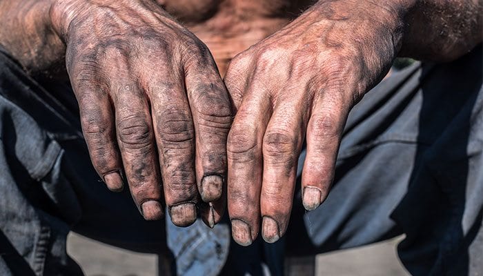 Report: Black Lung Disease Continues to Spread over America’s Coal Miner Territory