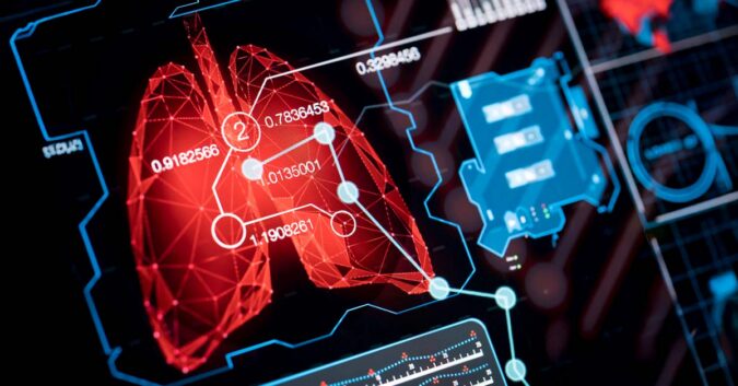 Using artificial intelligence (AI) to detect or treat lung cancer and mesothelioma in 2026