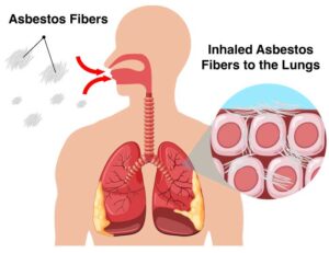 Asbestos Diagram