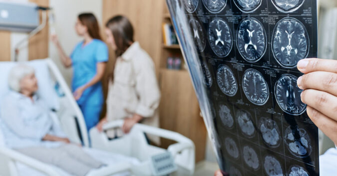 Doctor reviewing brain scans of a patient