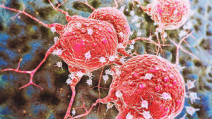 Cancer cells