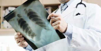 doctor holding a chest x-ray