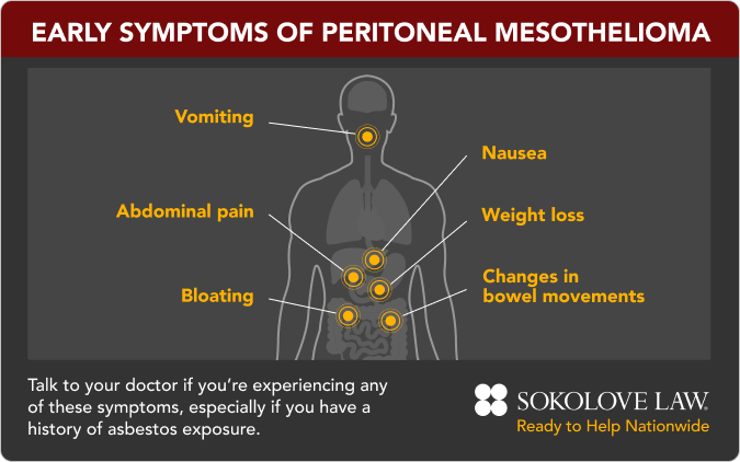 Early peritoneal mesothelioma symptoms