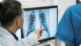 doctor pointing at mesothelioma X-rays